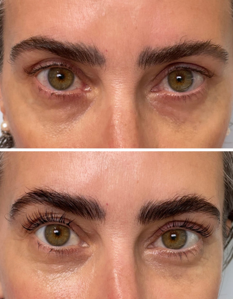 Lash Lift